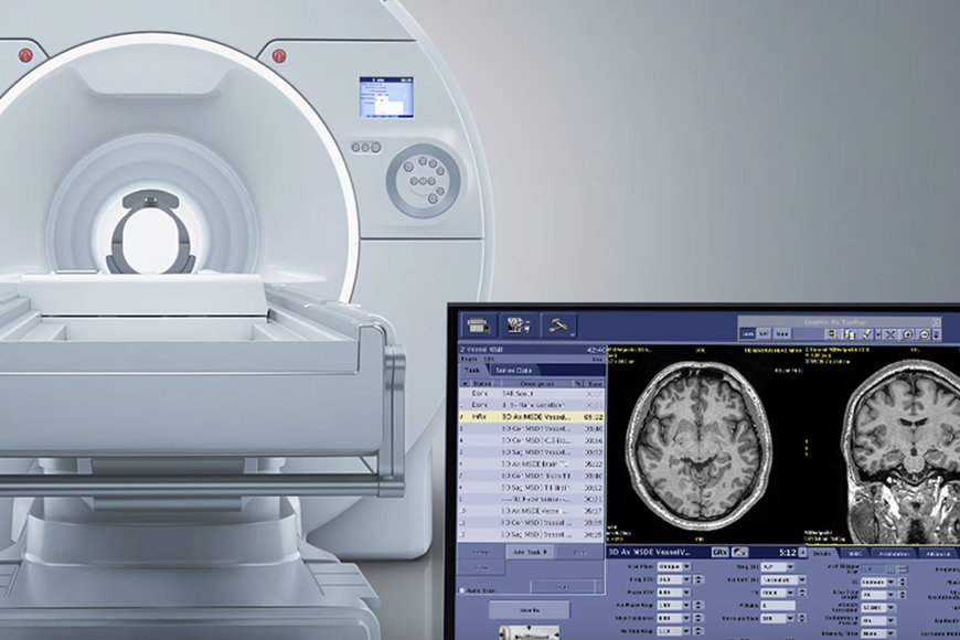 GE HealthCare Receives FDA Clearance for SIGNA MAGNUS 3.0T MRI System